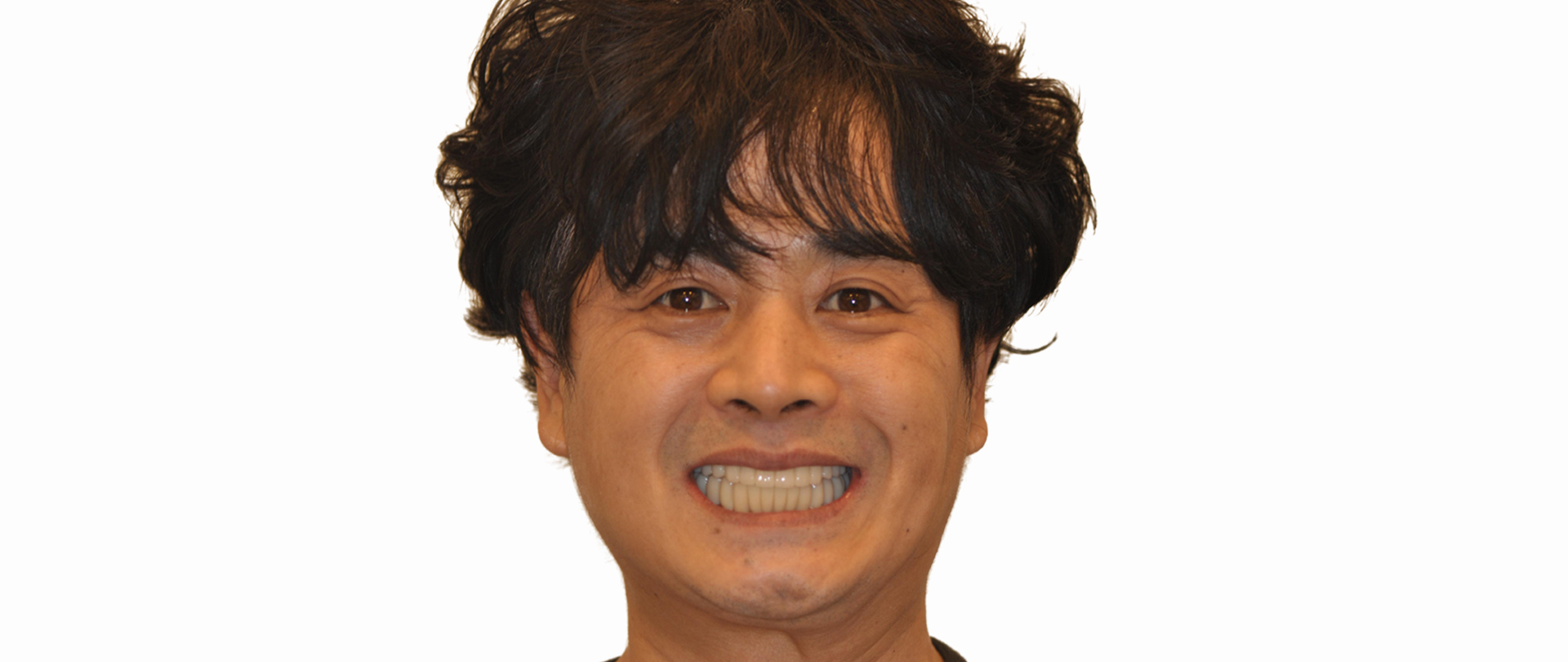 전후사진 후