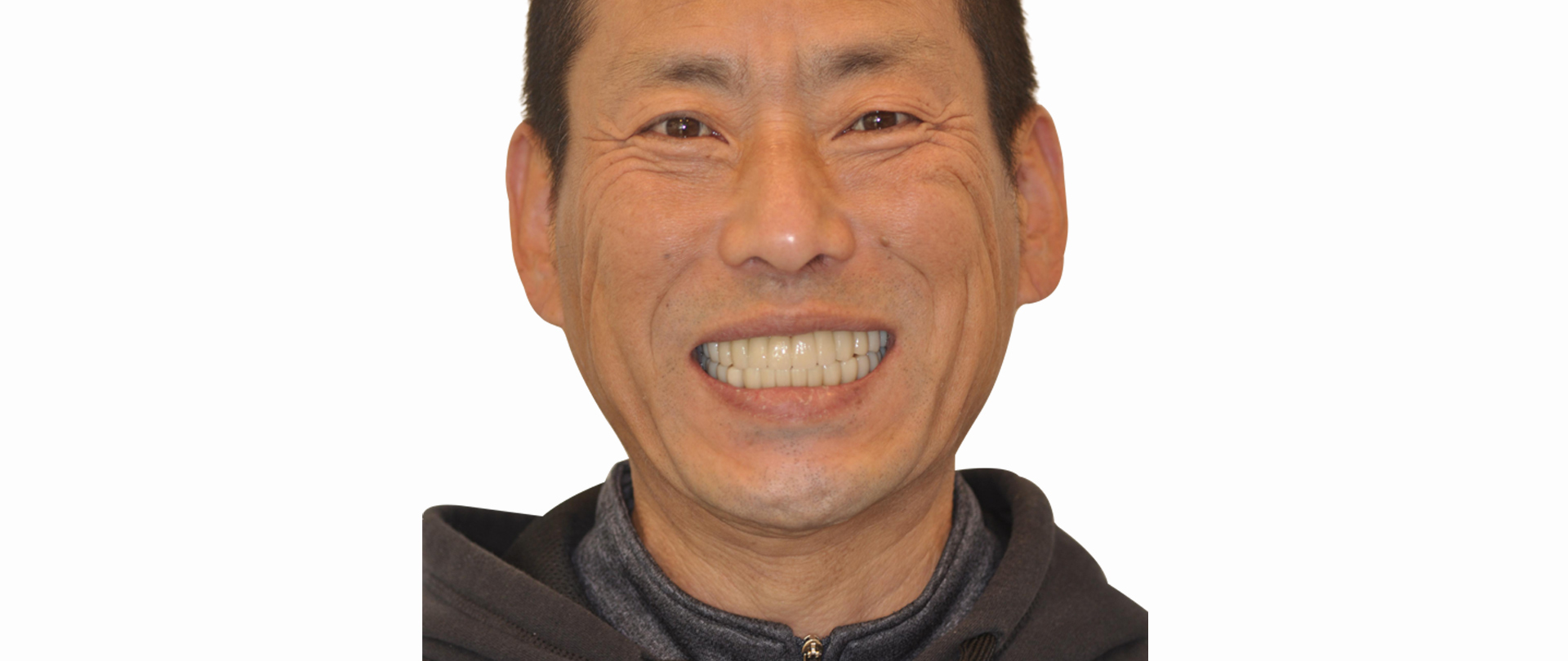 전후사진 전
